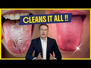 How to GET RID of WHITE TONGUE & Tongue Coating? | The TRUTH REVEALED.
