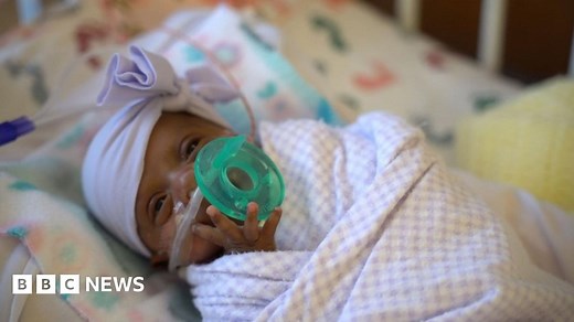 'World's smallest' surviving premature baby released from US hospital