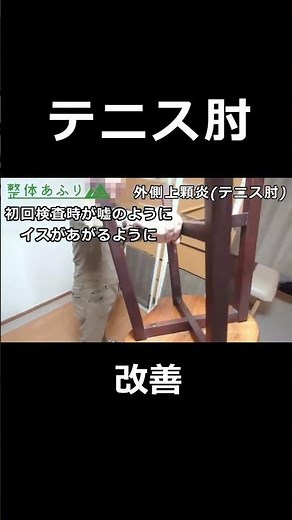 【厚木市・本厚木の整体】物を持つと肘が痛いテニス肘（外側上顆炎）→改善したビフォーアフター