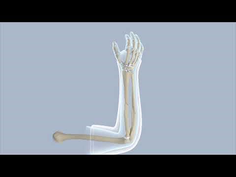 Closed Reduction of a Forearm Fracture