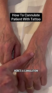 How to Cannulate Patients With Tattoos ASSESSMENT GUIDE 🔗’ED IN BIO #paramedic #studentparamedic #ambulance #emt #learnontiktok