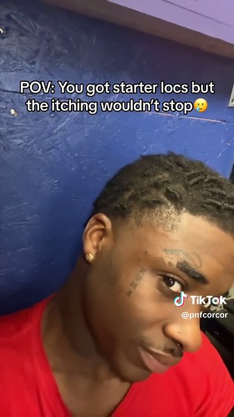 Dreadlock Journey: Tips to Manage Itching and Care