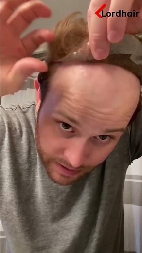 Breaking Down Hair System Installation for You! | Lordhair Men‘s Hairpieces