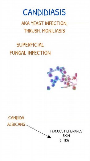 CANDIDIASIS