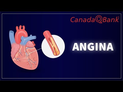 Angina: Types, Symptoms, Diagnosis & Treatment | Cardiology Review | CanadaQBank