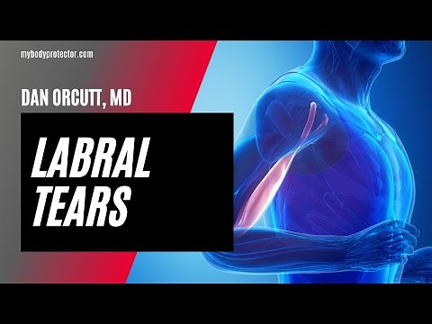 Labral Bicep Tears - Dan Orcutt, MD, Orthopedic Surgeon