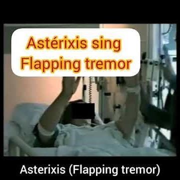 Astérixis sign (flapping tremor)