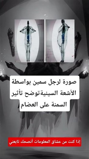 صورة لرجل سمين بواسطة الأشعة 🤯!!
