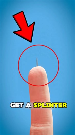 Stop Pulling Splinters Like This… Try This Instead 😳