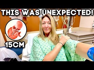 SURGERY DAY ❤️‍🩹 GIGANTIC Dermoid Ovarian Cyst Removal