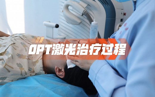 OPT激光治疗过程