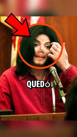 WHY DID MICHAEL JACKSON LOSE HIS NOSE? 🤔