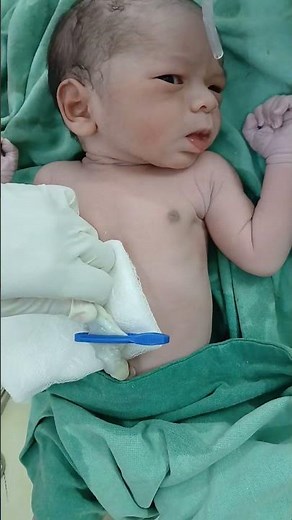 Just delivary Cord cleam New baby✂️🥰✂️