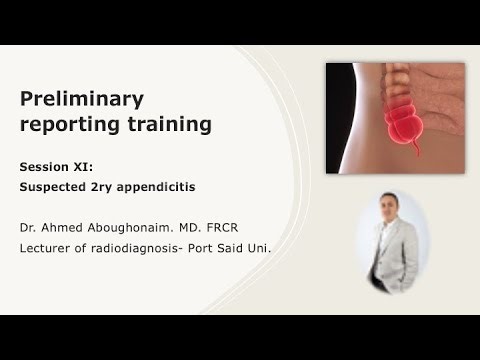 | Case 11 | Suspected 2ry Perforated appendicitis with abscess formation