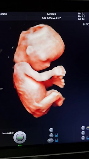 Eco Doppler Heart - Santiago 5D