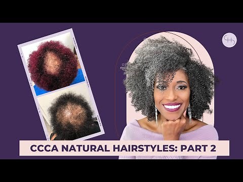 5 Essential CCCA Alopecia Hairstyles You Need to Know