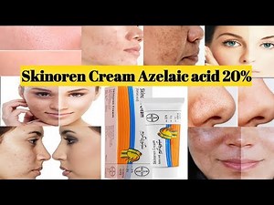 Skinoren Cream Uses and side effects/Skinoren Cream how to Use/ Azelaic acid Cream review.
