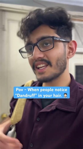 When people notice dandruff in your hair 🙆‍♂️#shorts #comedy