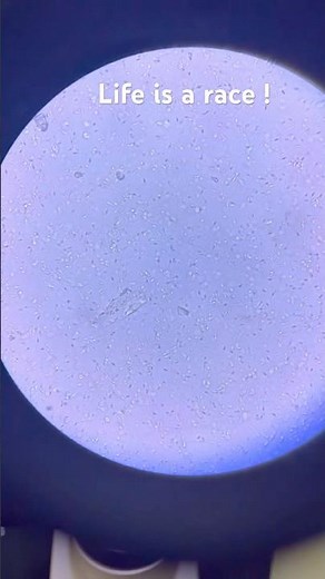 You’re watching the race that decided your existence. 🔬🏆 #fertility #science #life