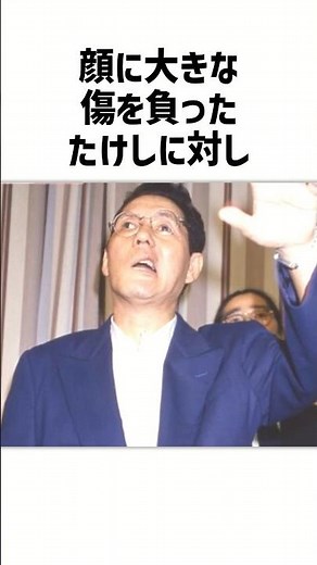 ㊗️30万再生🎉ビートたけしのデカ過ぎる器…この男、芸人として偉大につき注意⚠️#松本人志#感動ストーリー