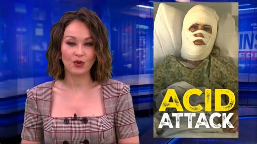 Ashley Wasielewski was heading home in Georgia when a stranger walked up behind her and poured acid over her head. Wasielewski's best friend Connor Milam and son Wesley have been by her side since the attack. The 46-year-old mom of two sons was transported to a trauma center with burns over 50 percent of her body. Wasielewski may never be able to grow hair on her head again. Now, as Wasielewski struggles to heal, her family is seeking justice. #CrimeNews #Georgia | Inside Edition