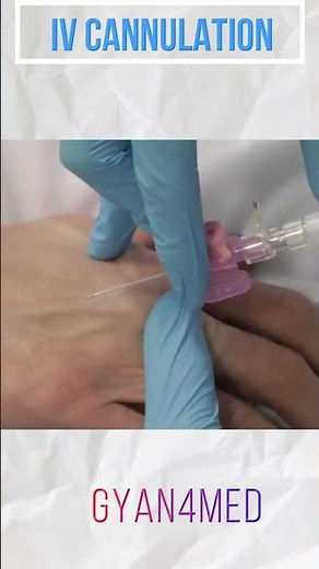 How to gain IV access | IV Cannulation
