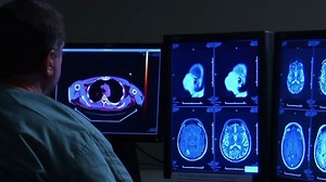 FIU Researchers Develop Algorithm That Can Diagnose Strokes With 84% Accuracy