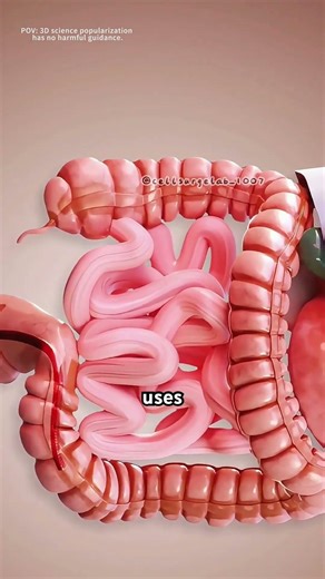 How polypectomy is done?(3D animation) #how #3danimation #medical3danimation #gastroenterology