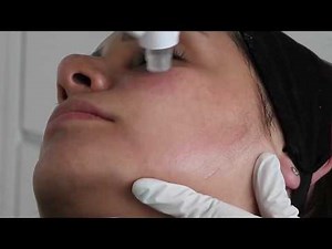 ENHANCE YOUR BEAUTY WITH ALL NEW HYDRA PEN H2