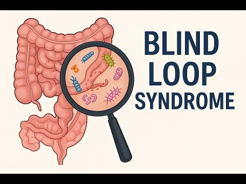 Blind Loop Syndrome