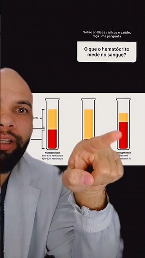 🩸 Hematocrit: what is this test used for?