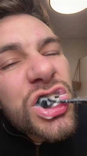 Changement de gouttières Invisalign en ASMR