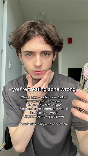 Acne Treatment Mistakes & Causes