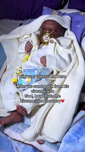 Baby Boy Circumcision Experience with Mom | Newborn Baby Journey