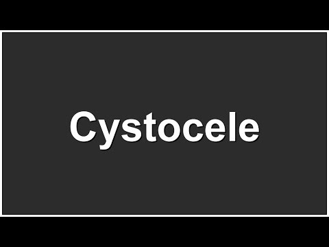 How to pronounce Cystocele