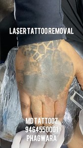 Remove your tattoo now with the safest method. . Call for appointment...