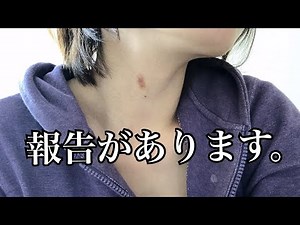 キスマークを付けられてしまいました。【お知らせ動画】