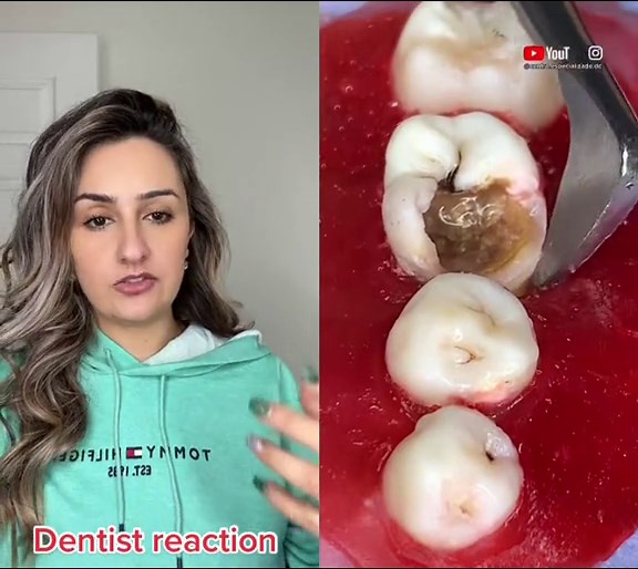 Tooth Extraction: Understanding the Procedure