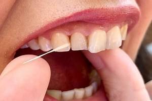 WHAT TYPE OF FLOSS IS BETTER? WHICH TYPE OF INTERDENTAL CLEANERS IS THE BEST? - Origins Dentistry
