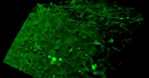 Scientists Grow Mini Brain Organoids From Stem Cells