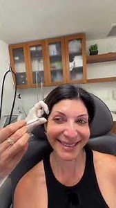 Where I get my Botox as a 55 year old #midlife