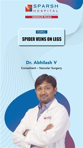 SPARSH Hospital, Hennur Road | Dr. Abhilash V | Spider Veins on Legs