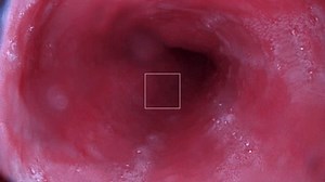 Gastroscopy examination of the gullet and stomach