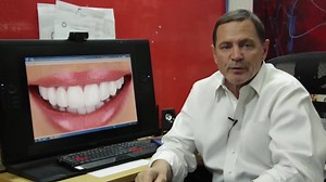 5.9K views · 100 reactions | Press On Veneers by Brighter Image Lab on Reels | Facebook