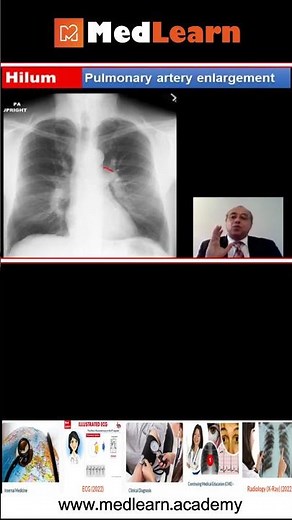 Medlearn (Quick note)