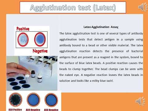 Practical agglutination tests ASO, CRP, RF