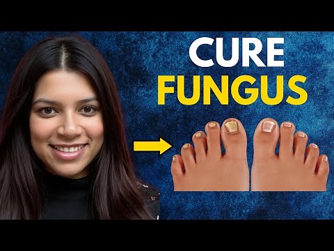 BEST TOENAIL FUNGUS TREATMENTS 2025 (Treatments that ACTUALLY Work)