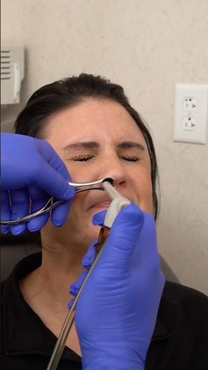 Nasopharyngoscopy Explained | Part 1 with Dr. Neil Van Leeuwen – Tanner Clinic #shorts