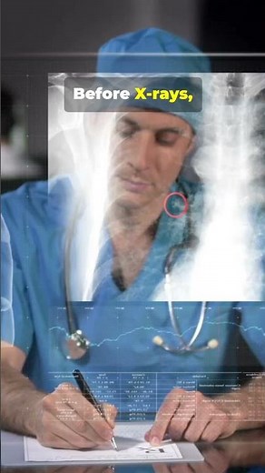 How X - rays Changed Medicine Forever!