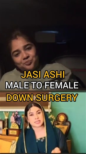 helen of sparta jasi ashi down surgery issue #arogyam #dentalcare #jasiashi #bbms7reels